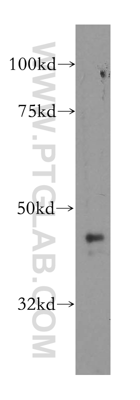 WB analysis of PC-3 using 13571-1-AP