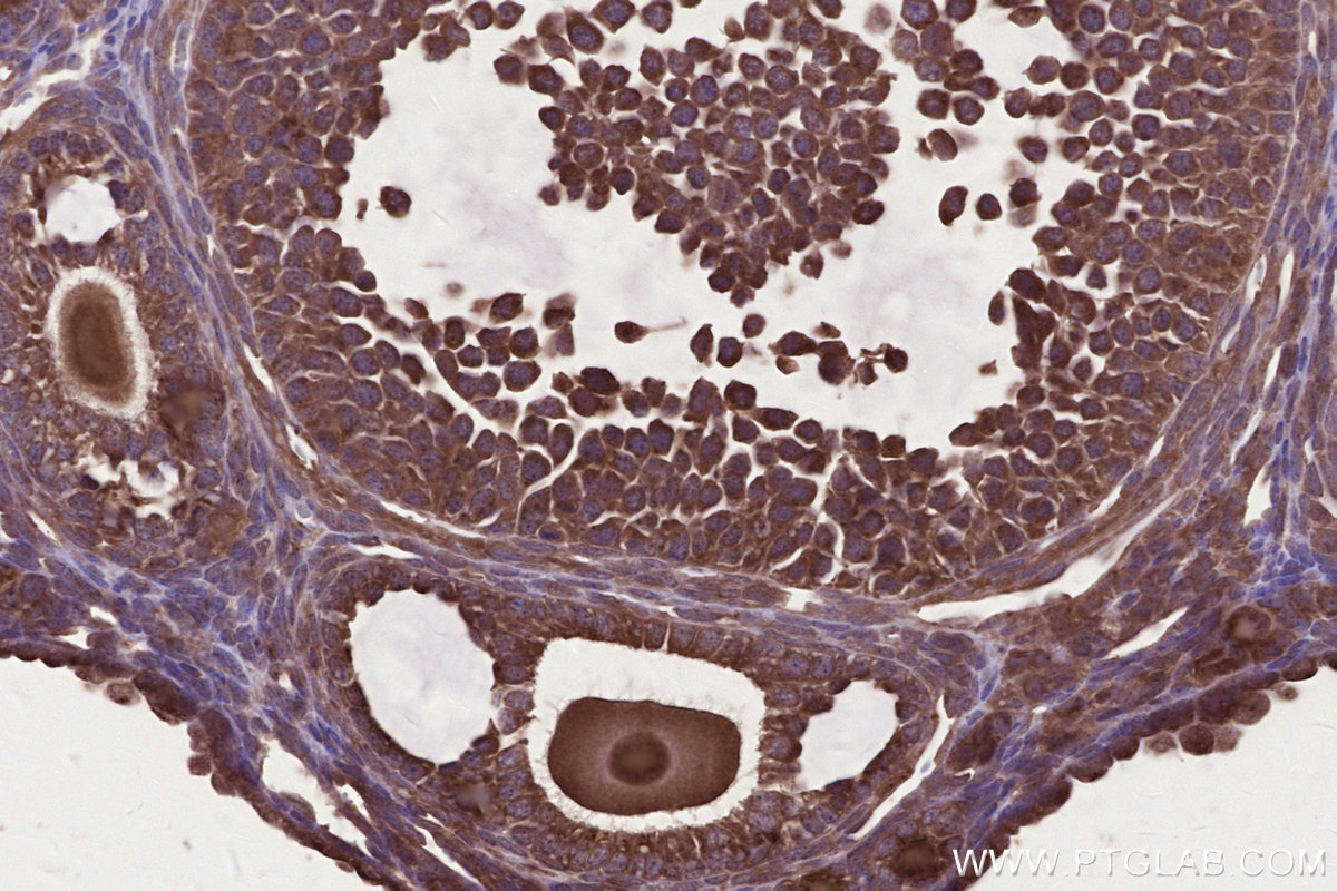 IHC staining of mouse ovary using 16519-1-AP IHC staining of mouse ovary using 16519-1-AP