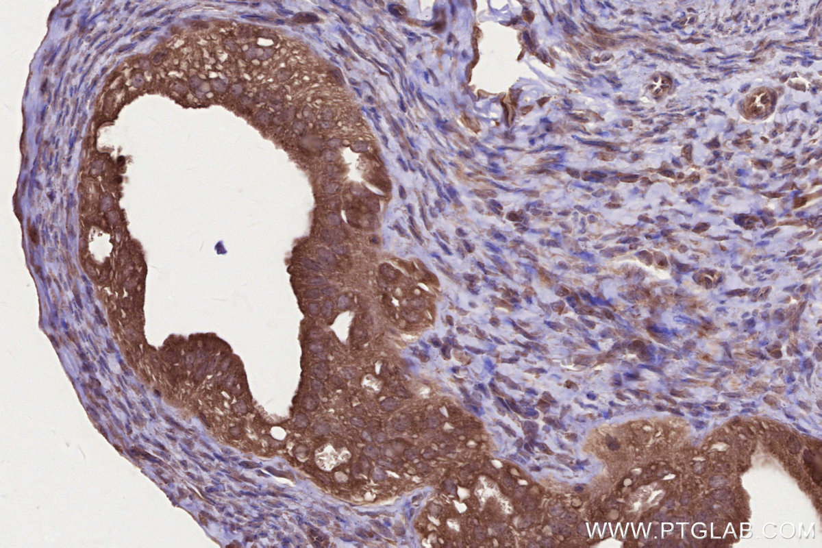 IHC staining of mouse ovary using 16519-1-AP IHC staining of mouse ovary using 16519-1-AP