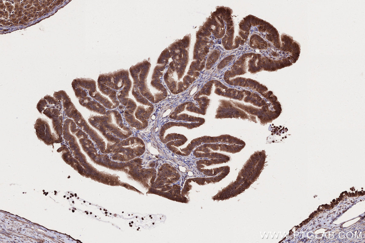 IHC staining of rat ovary using 16519-1-AP IHC staining of rat ovary using 16519-1-AP