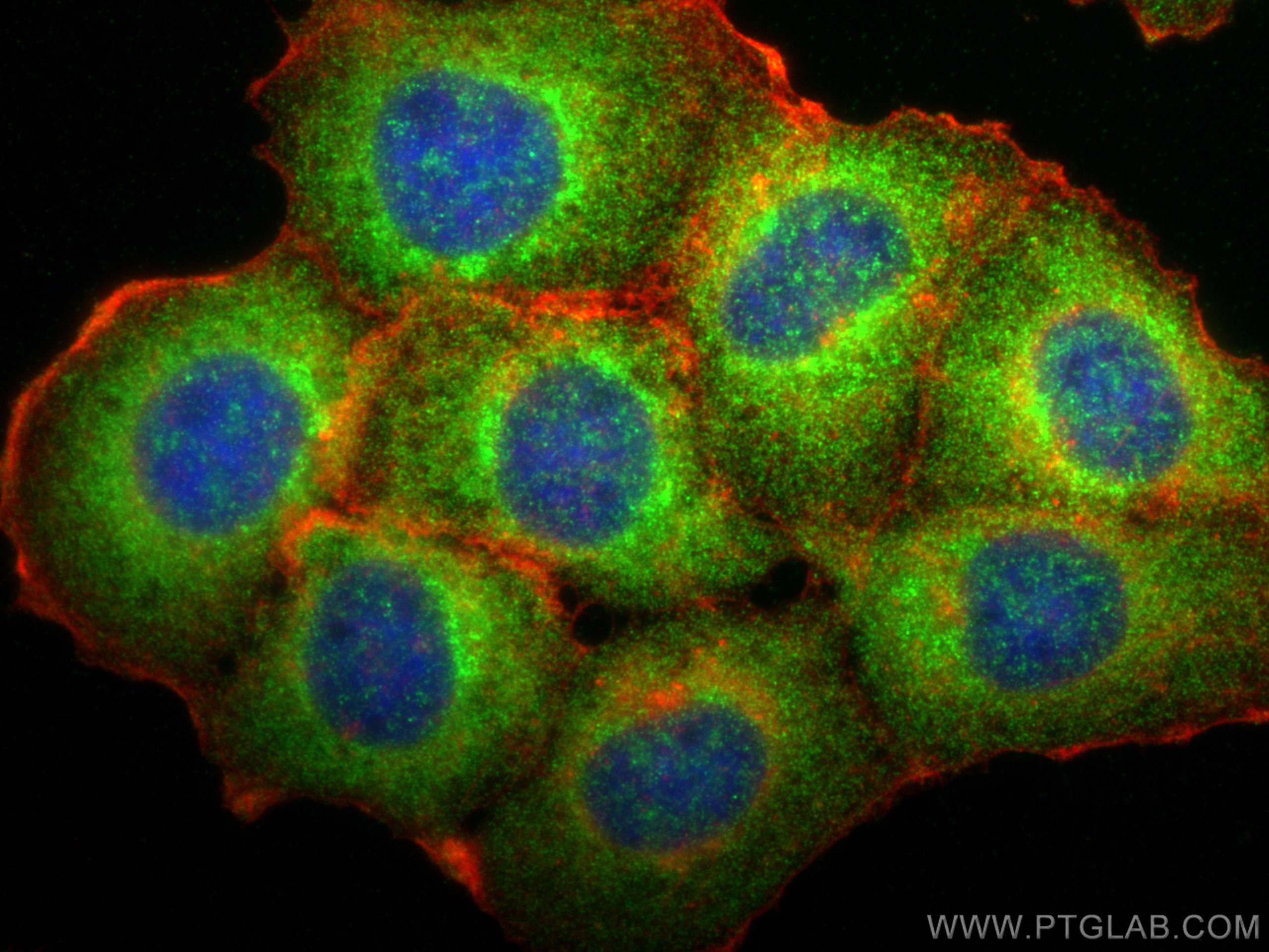 IF Staining of A431 using 15293-1-AP