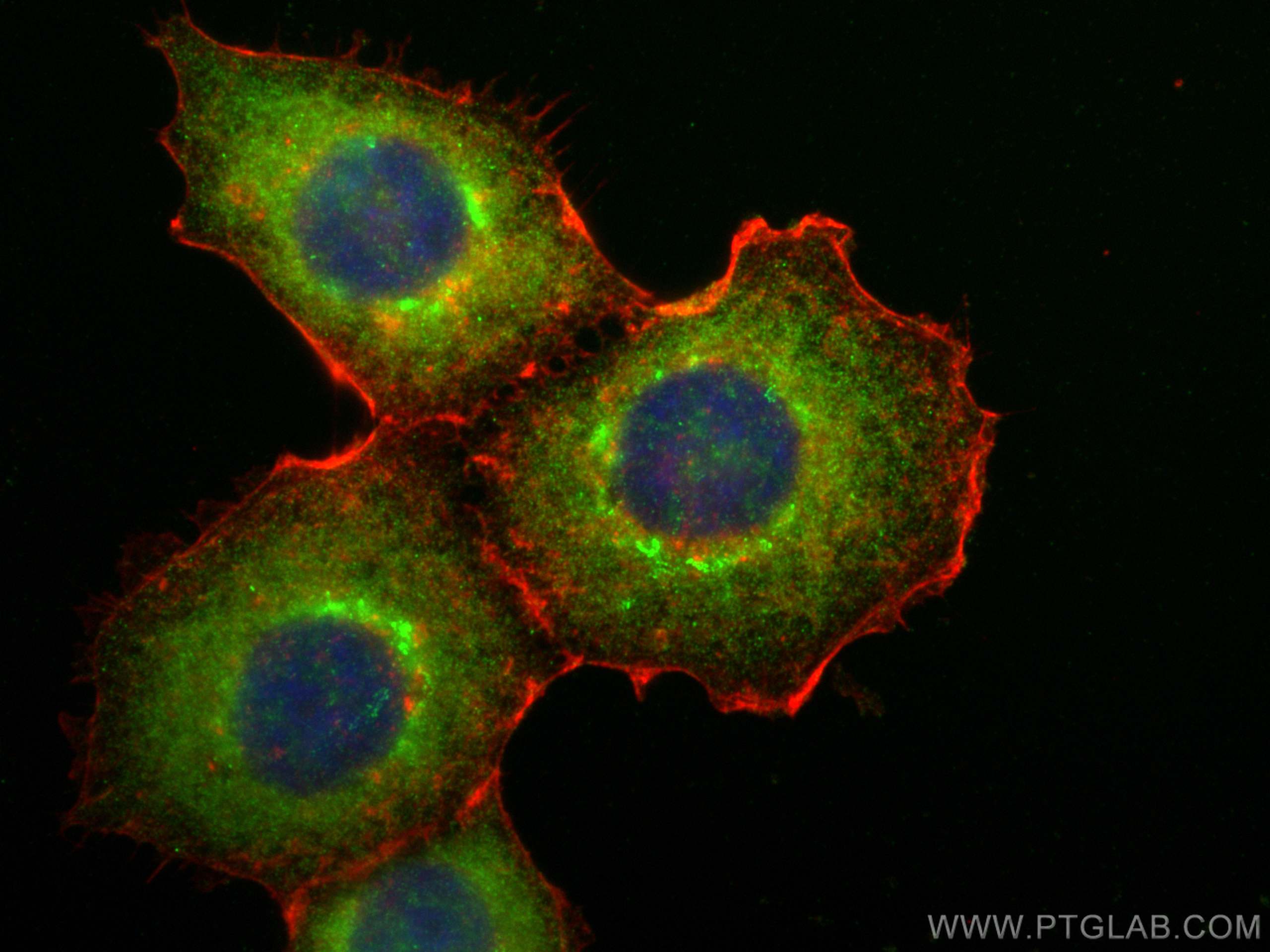 IF Staining of A431 using 15293-1-AP