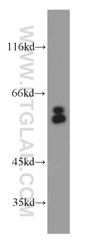 WB analysis of HepG2 using 15293-1-AP