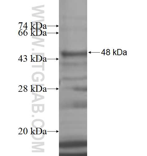 ARFGAP3 fusion protein Ag7638 SDS-PAGE ARFGAP3 fusion protein Ag7638 SDS-PAGE