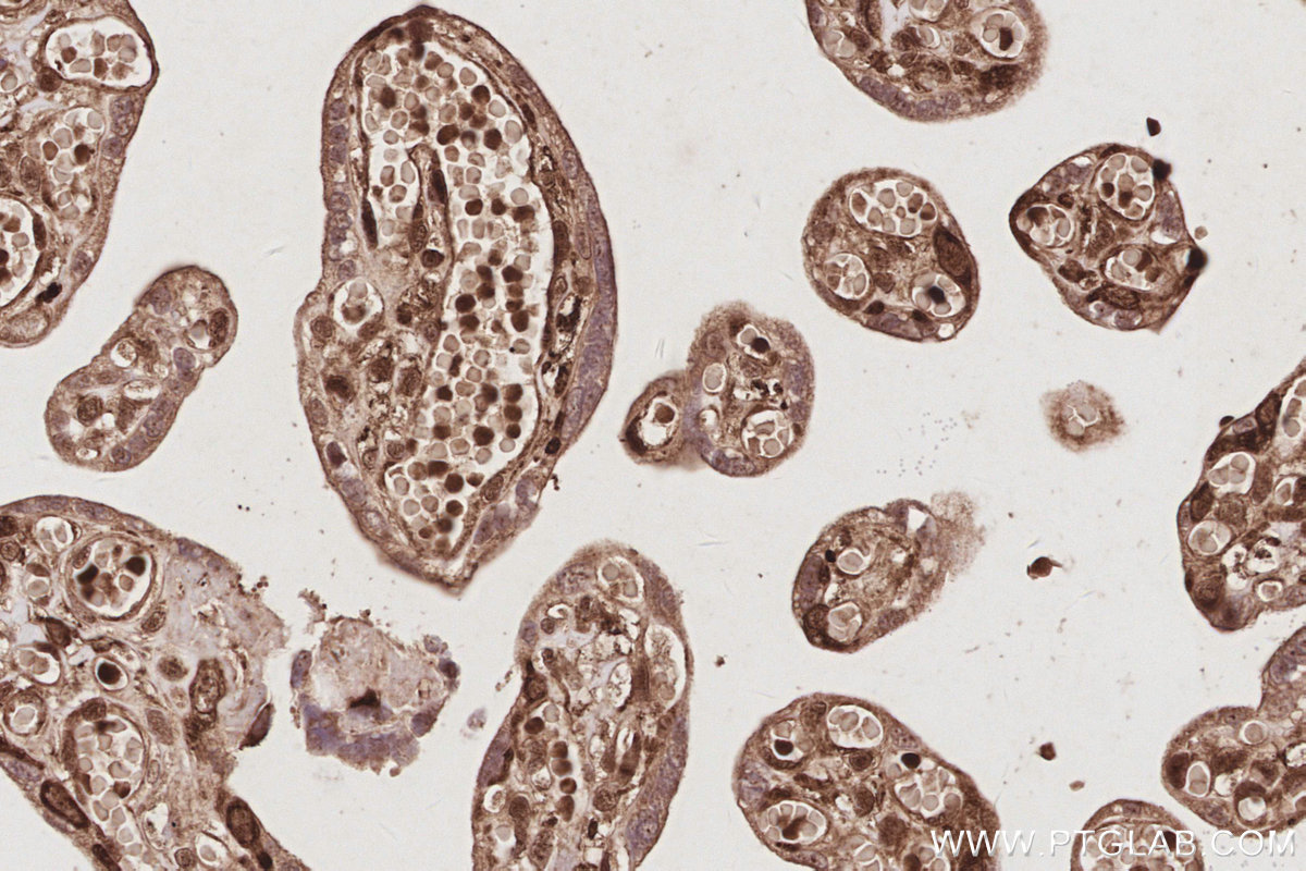 IHC staining of human placenta using 31684-1-AP