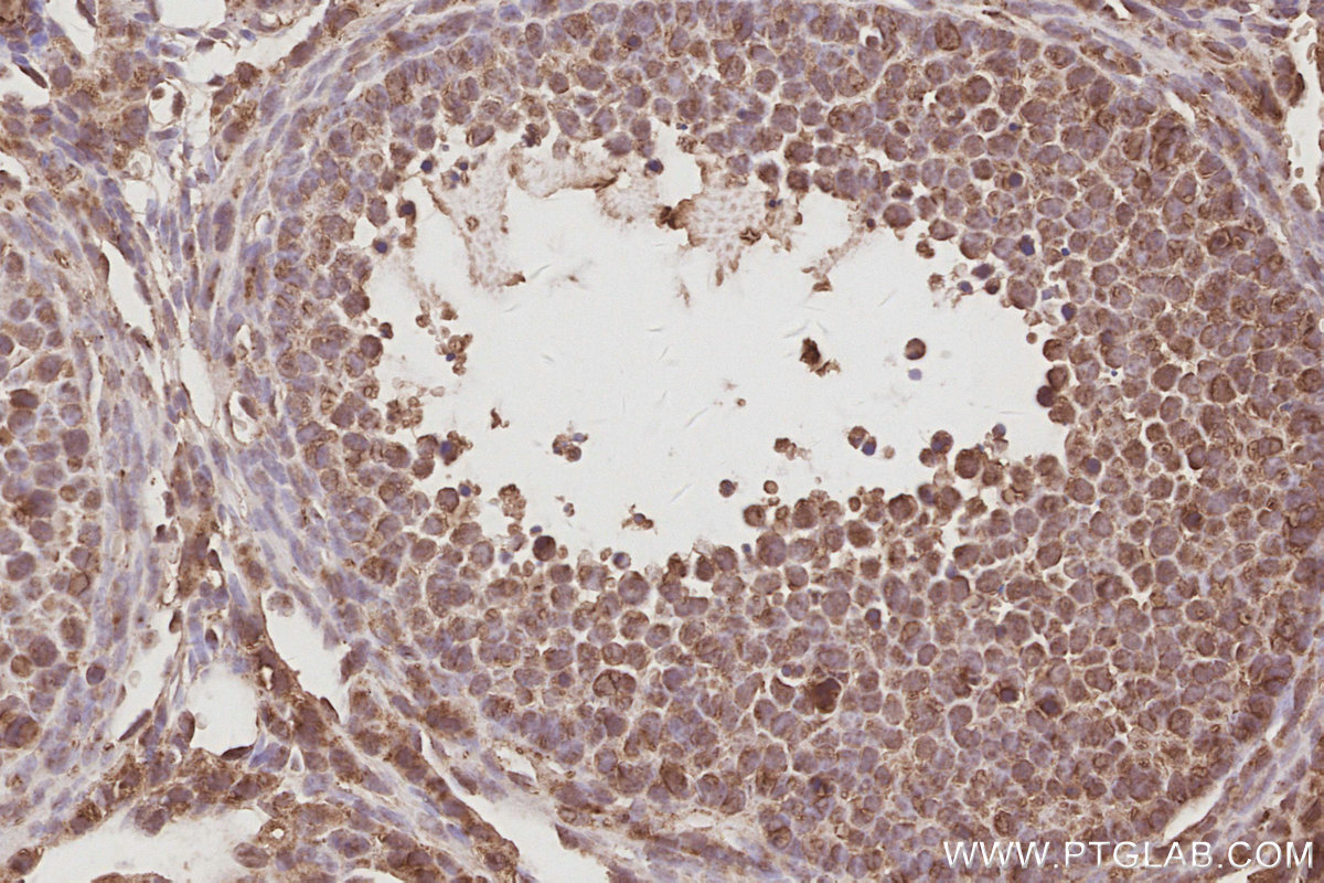 IHC staining of mouse ovary using 31684-1-AP