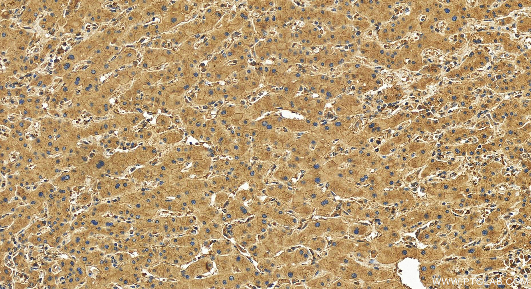 ARFGEF2