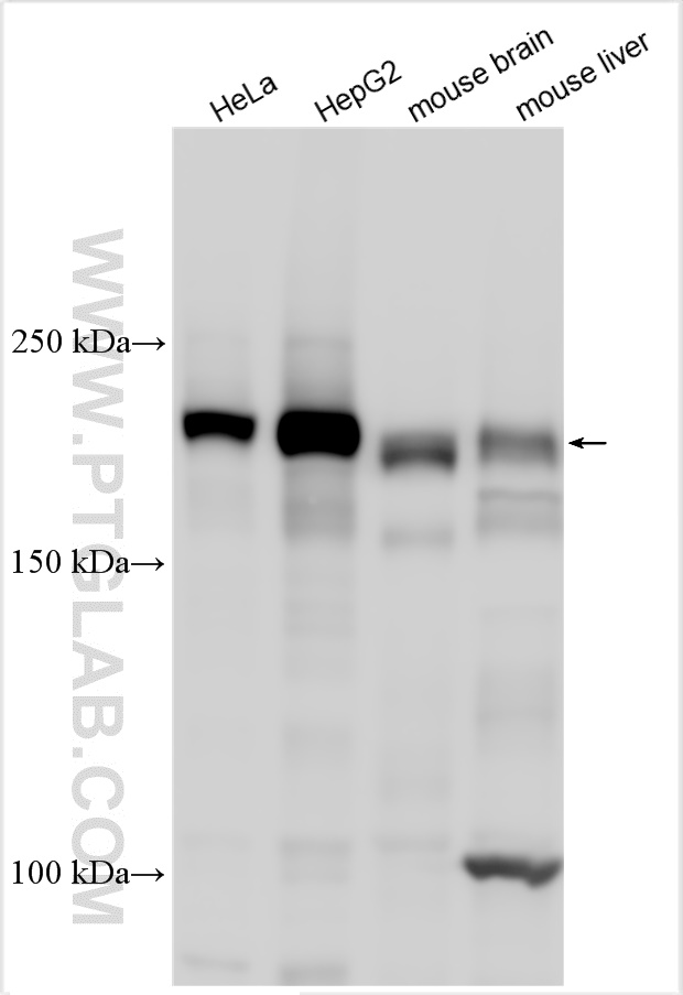 WB analysis using 31277-1-AP