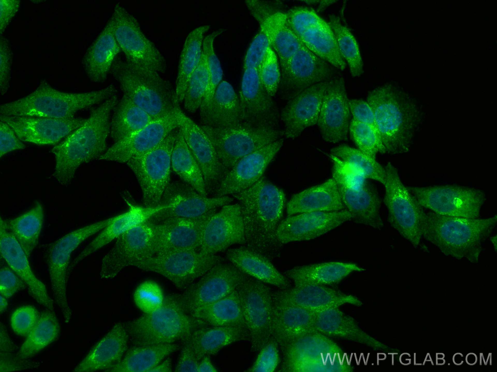 IF Staining of HepG2 using 17726-1-AP