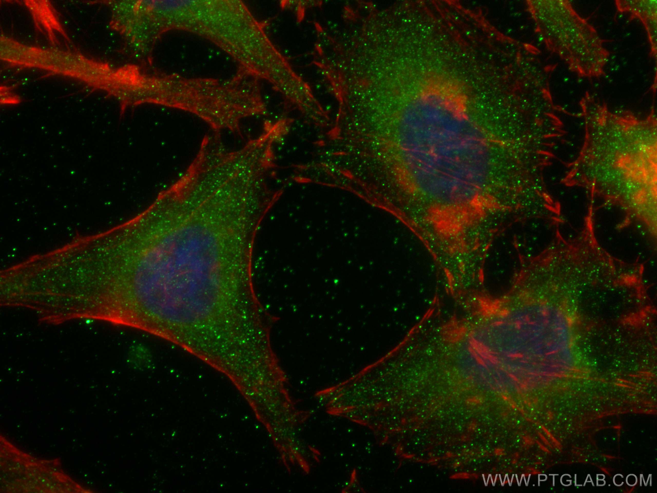 IF Staining of HeLa using 67461-1-Ig