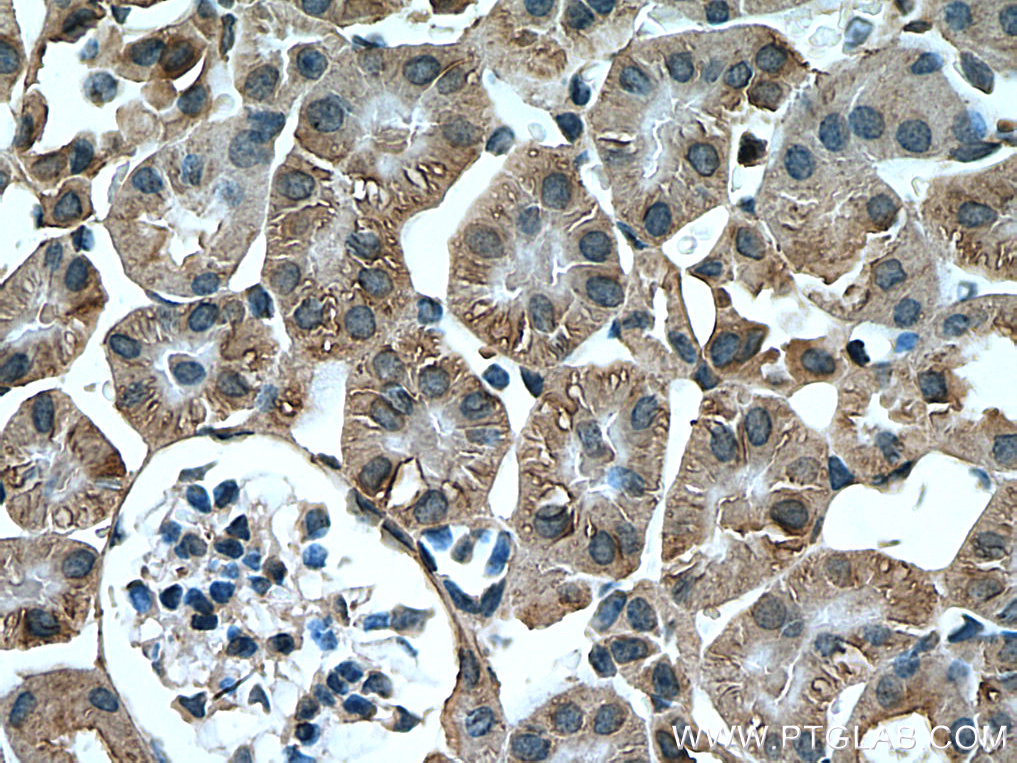 IHC staining of mouse kidney using 67461-1-Ig