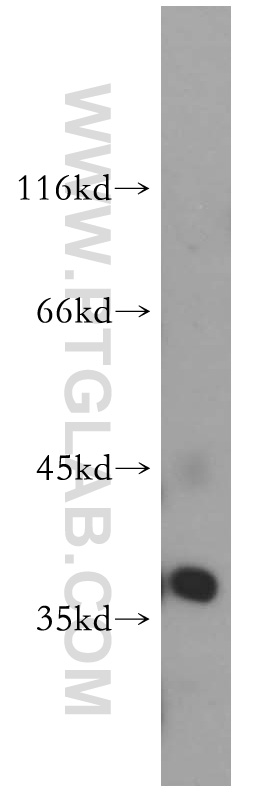 WB analysis of HeLa using 14548-1-AP