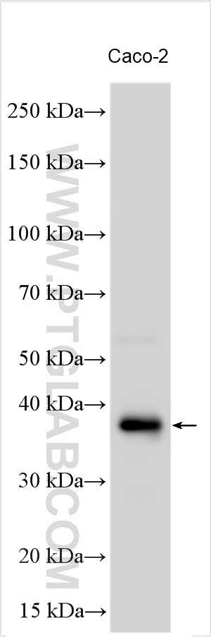 WB analysis using 14825-1-AP