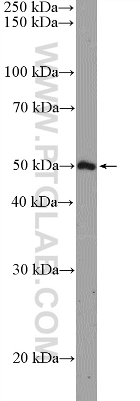 ARHGAP1 Polyclonal antibody