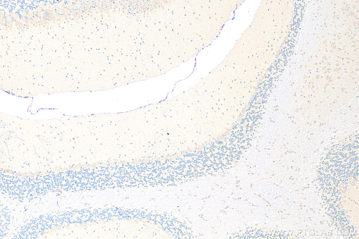 IHC staining of mouse cerebellum using 17855-1-AP