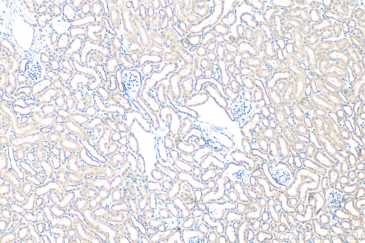 IHC staining of mouse kidney using 17855-1-AP