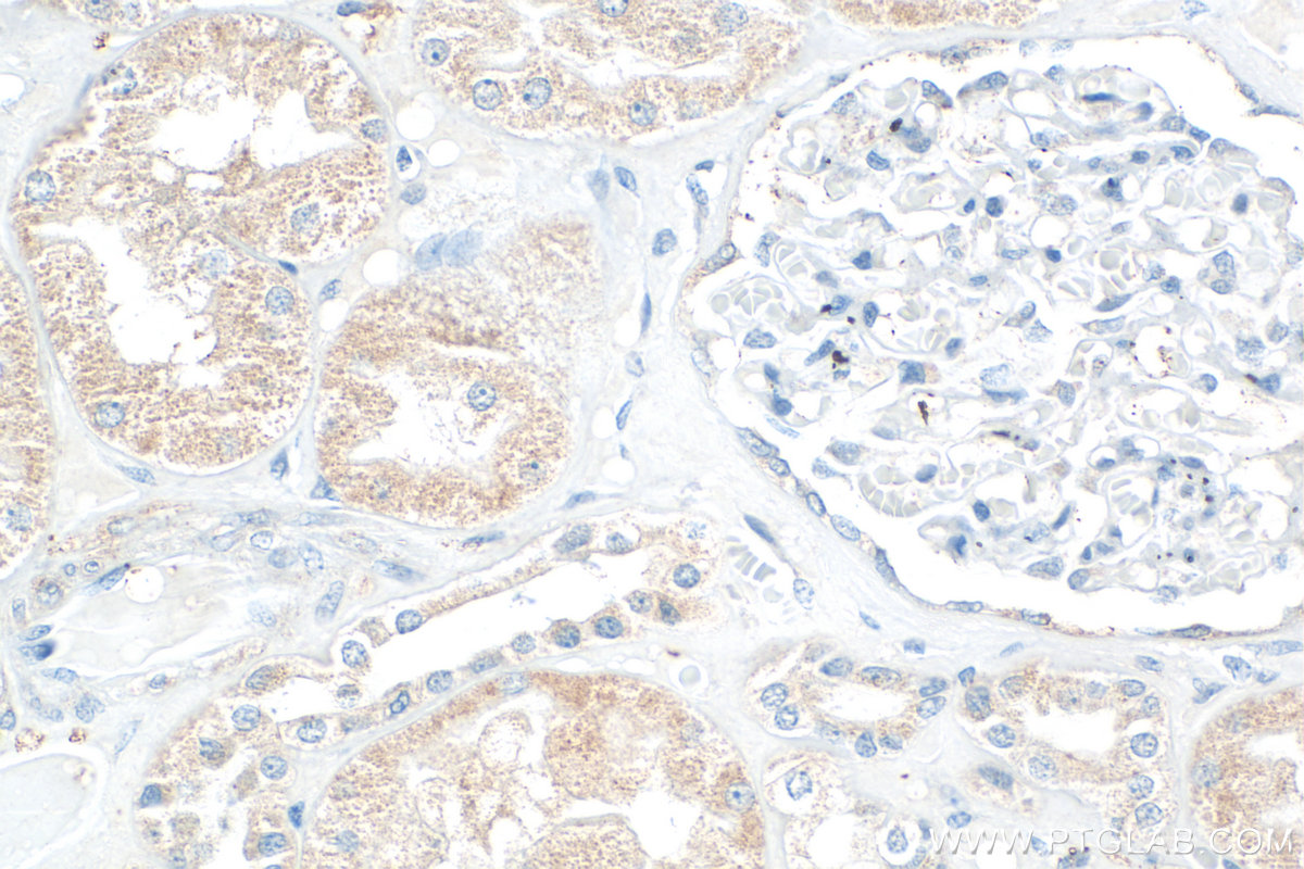 IHC staining of human kidney using 17855-1-AP