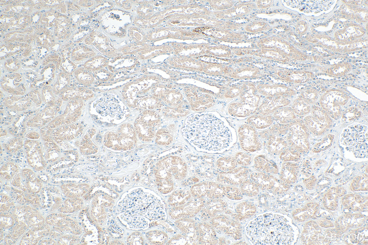 IHC staining of human kidney using 17855-1-AP