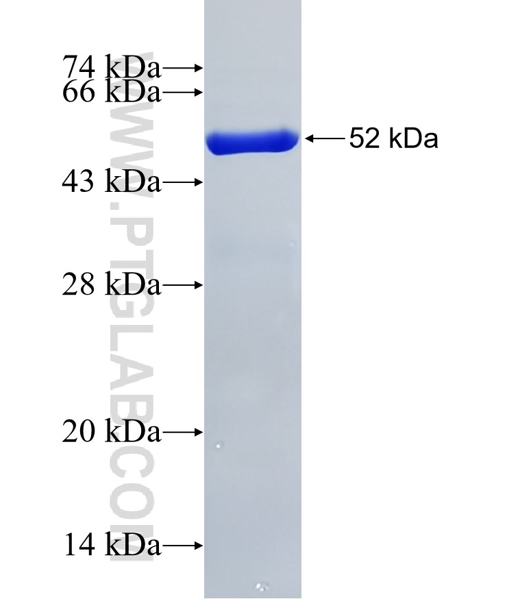 ARHGAP15 fusion protein Ag32274 SDS-PAGE ARHGAP15 fusion protein Ag32274 SDS-PAGE