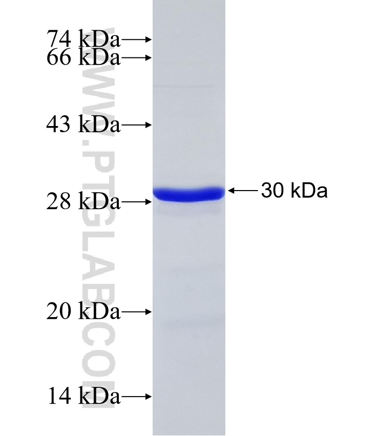 ARHGAP15 fusion protein Ag32276 SDS-PAGE