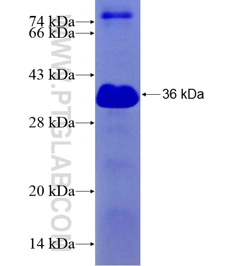 ARHGAP18 fusion protein Ag29144 SDS-PAGE