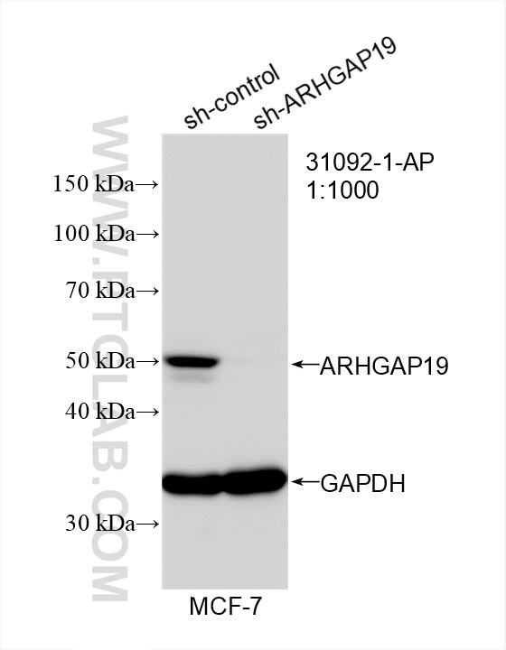 WB analysis of MCF-7 using 31092-1-AP