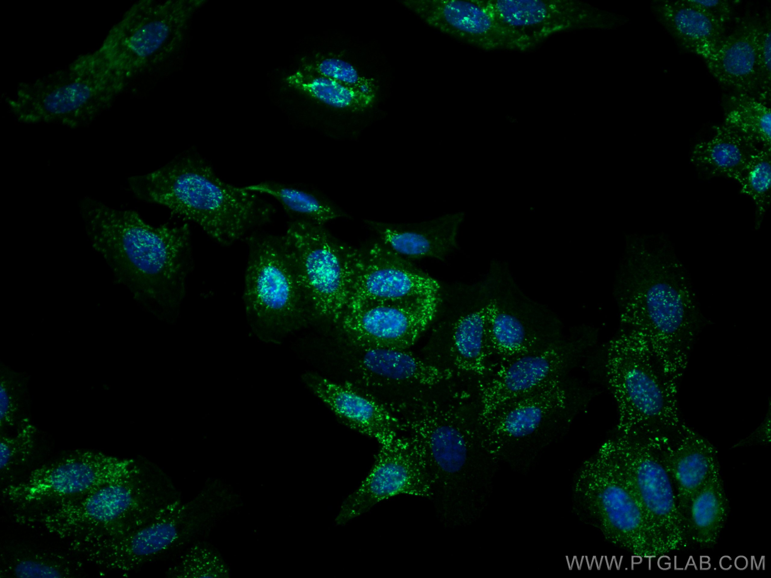 IF Staining of HepG2 using 22183-1-AP