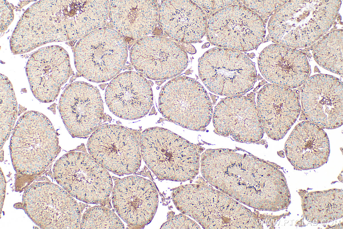 IHC staining of mouse testis using 31938-1-AP