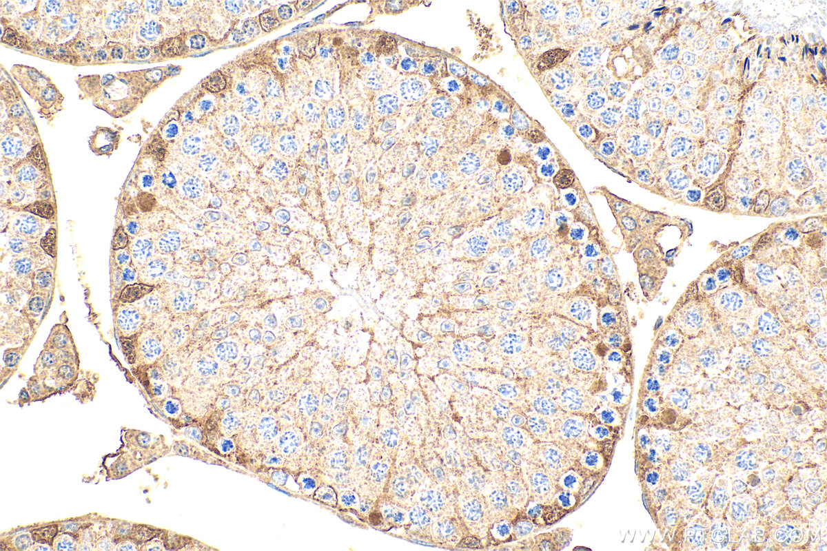 IHC staining of mouse testis using 31938-1-AP