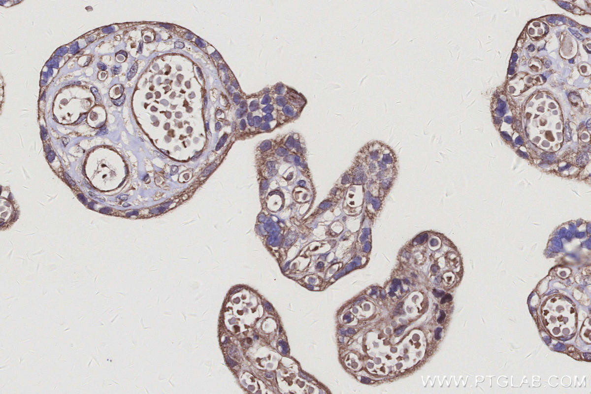 IHC staining of human placenta using 31938-1-AP IHC staining of human placenta using 31938-1-AP