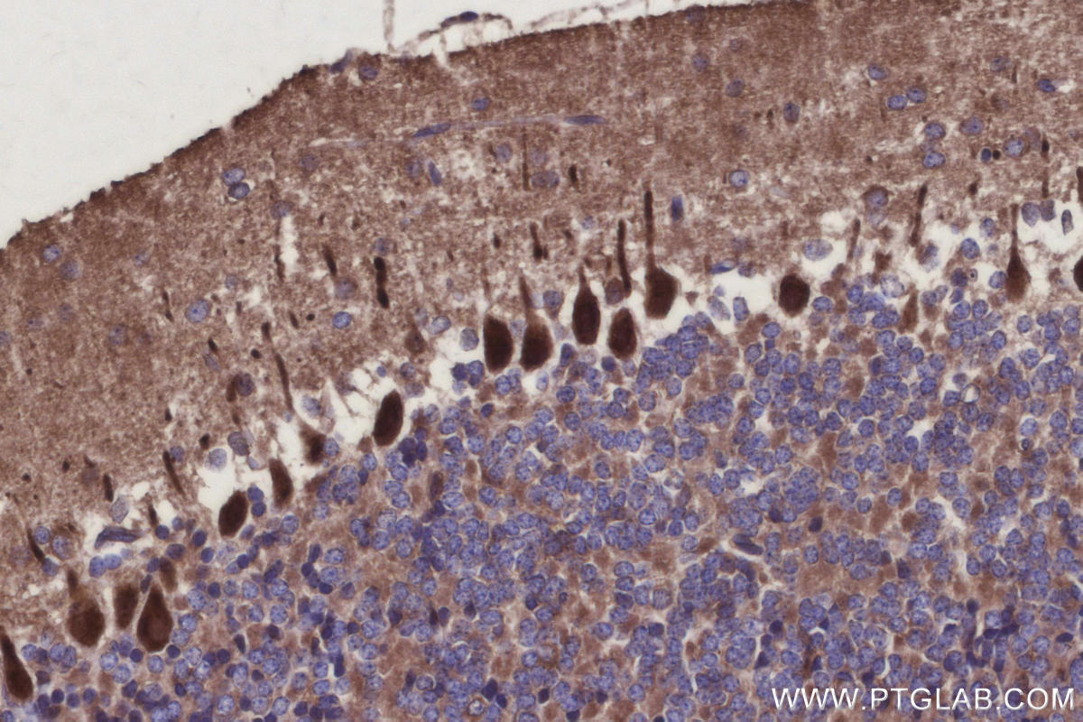 IHC staining of mouse cerebellum using 31938-1-AP IHC staining of mouse cerebellum using 31938-1-AP