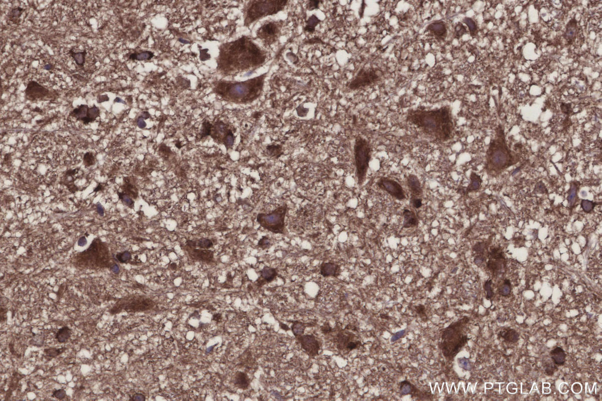 IHC staining of mouse cerebellum using 31938-1-AP IHC staining of mouse cerebellum using 31938-1-AP