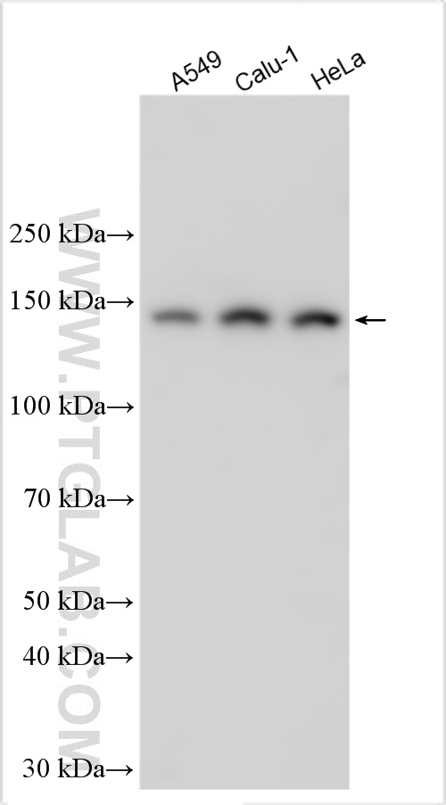WB analysis using 31938-1-AP