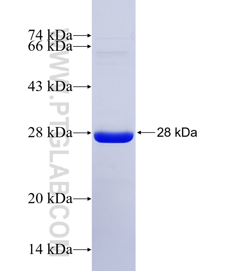 ARHGAP23 fusion protein Ag36340 SDS-PAGE ARHGAP23 fusion protein Ag36340 SDS-PAGE