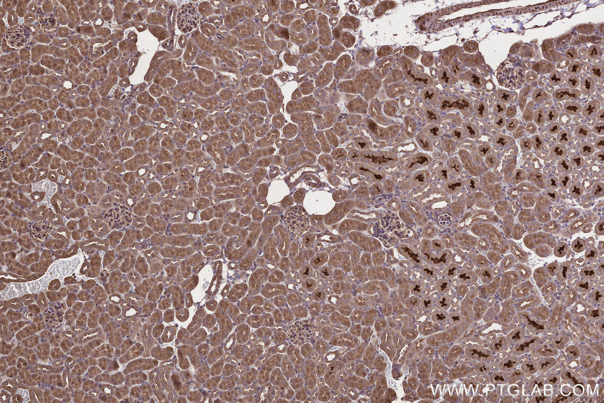 IHC staining of mouse kidney using 18834-1-AP IHC staining of mouse kidney using 18834-1-AP