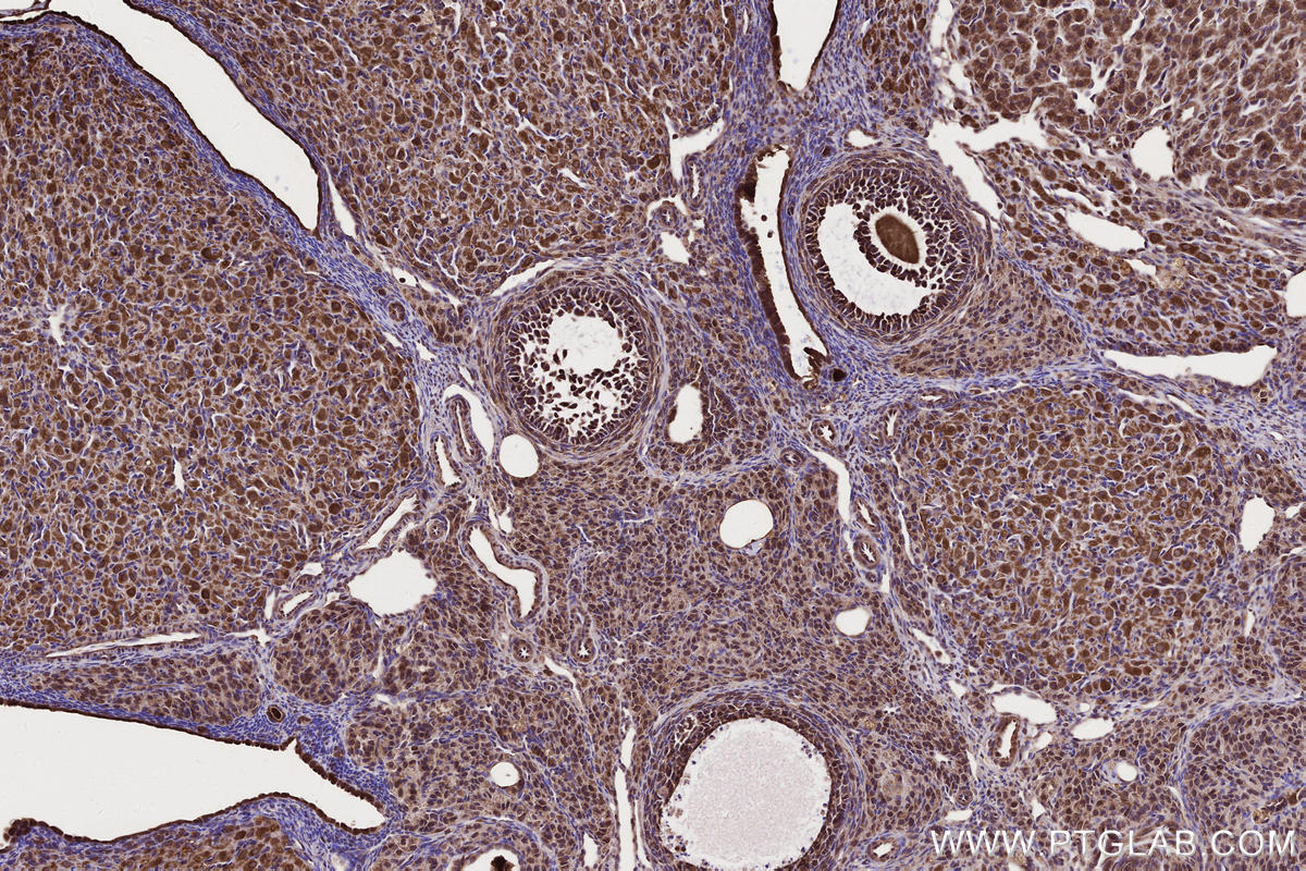 IHC staining of rat ovary using 18834-1-AP IHC staining of rat ovary using 18834-1-AP