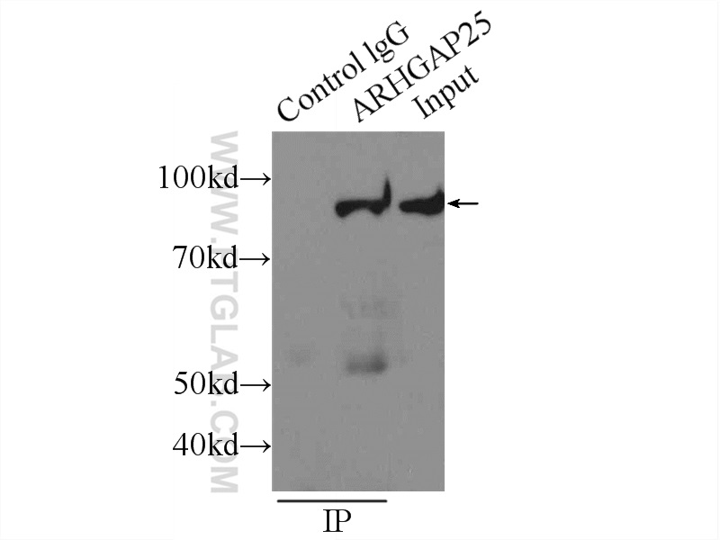 IP experiment of Jurkat using 14349-1-AP