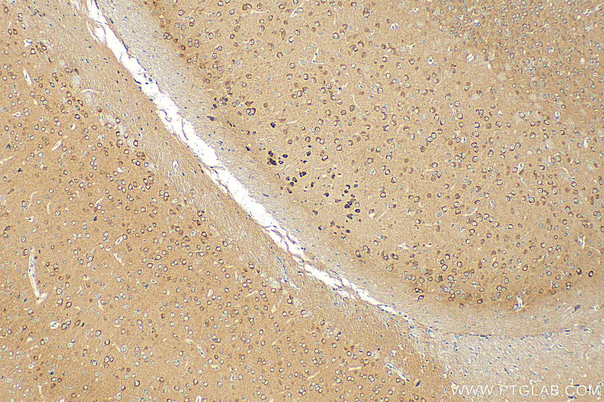 IHC staining of mouse brain using 17747-1-AP