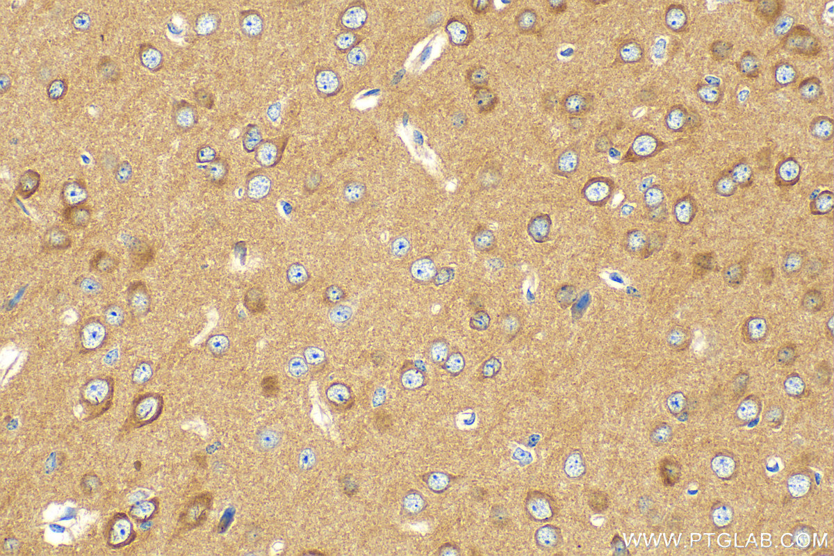 IHC staining of mouse brain using 17747-1-AP