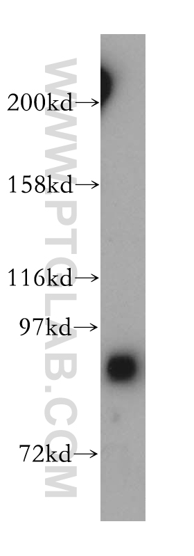 WB analysis of HeLa using 17747-1-AP