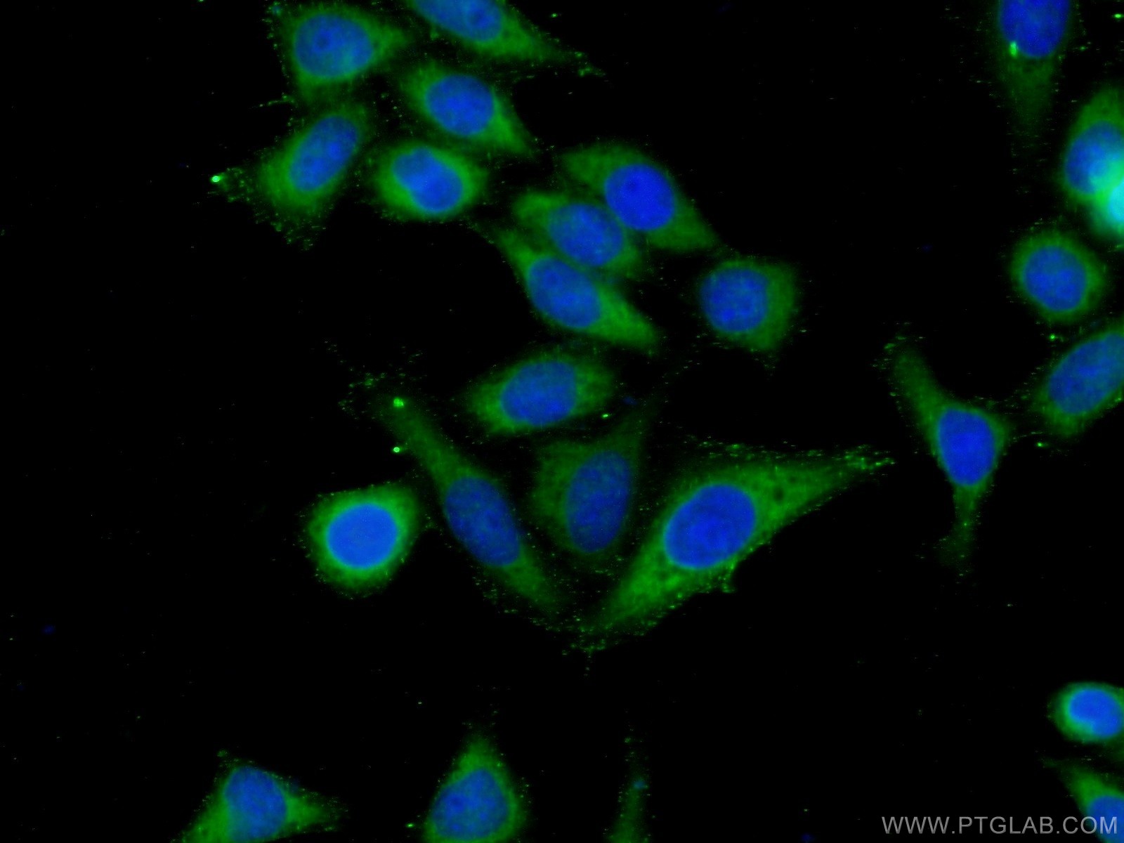 IF Staining of HeLa using 22077-1-AP