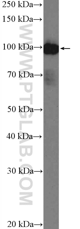 WB analysis of A549 using 22077-1-AP