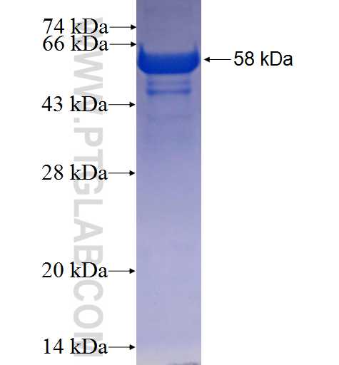 ARHGAP28 fusion protein Ag25293 SDS-PAGE