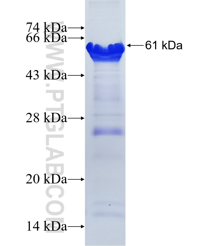 ARHGAP30 fusion protein Ag13226 SDS-PAGE ARHGAP30 fusion protein Ag13226 SDS-PAGE