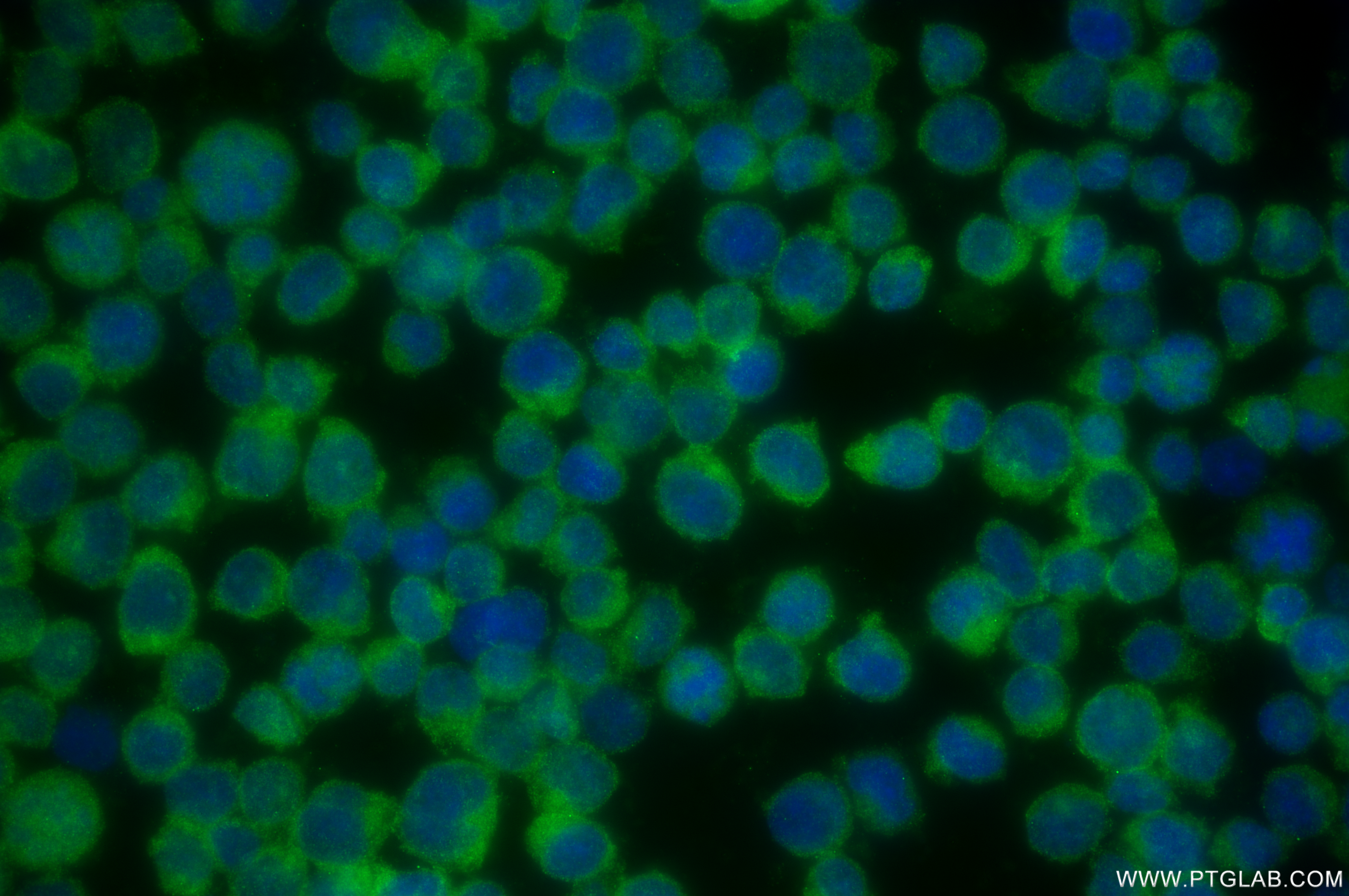 IF Staining of Jurkat using 85648-2-RR