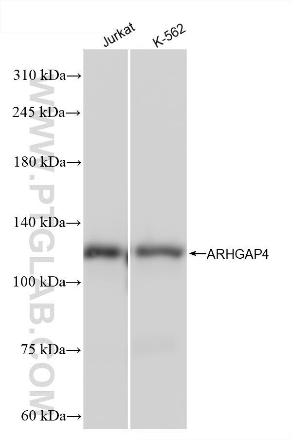 WB analysis using 85648-2-RR