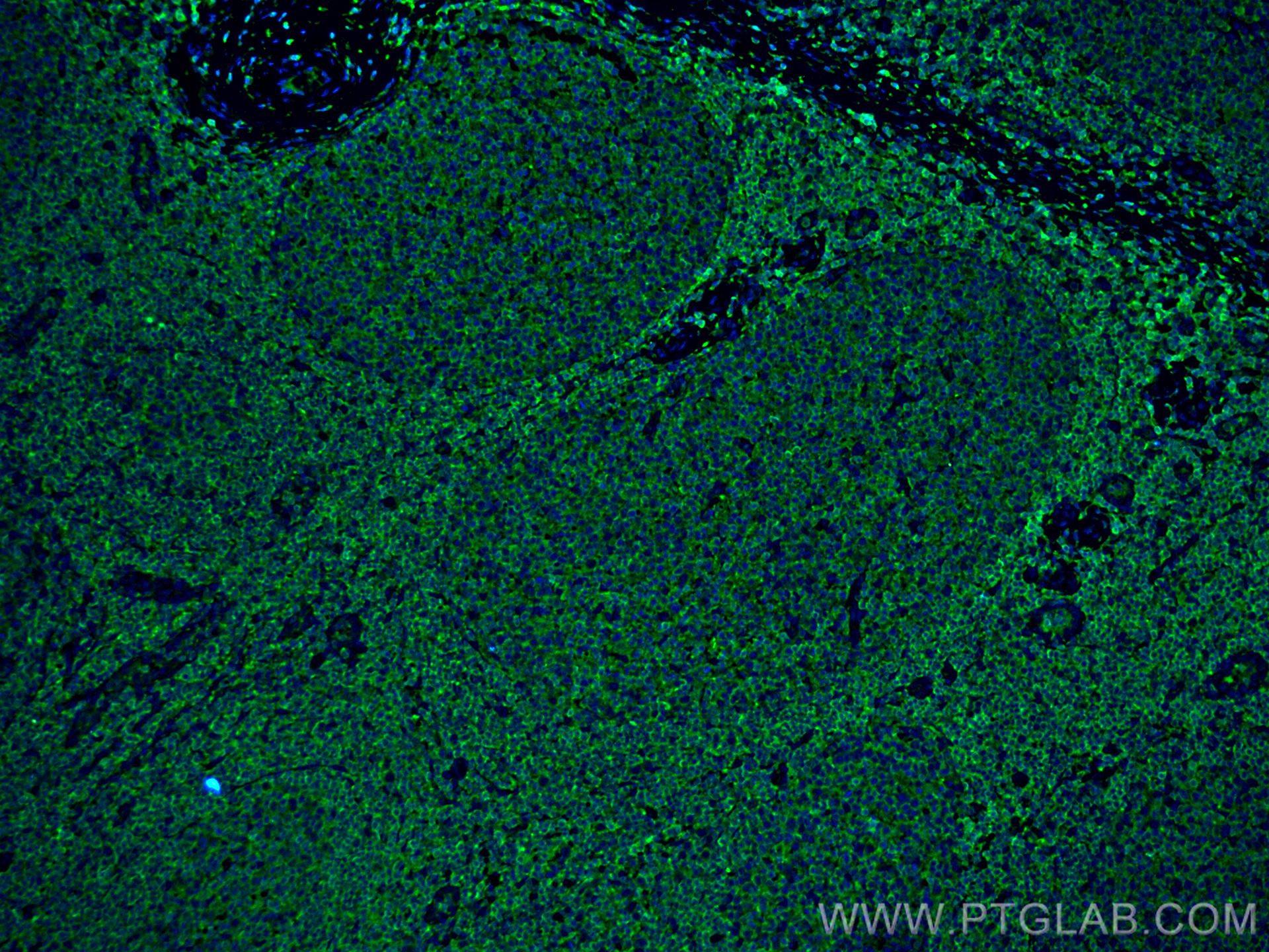 IF Staining of human tonsillitis using 66054-1-Ig (same clone as 66054-1-PBS)