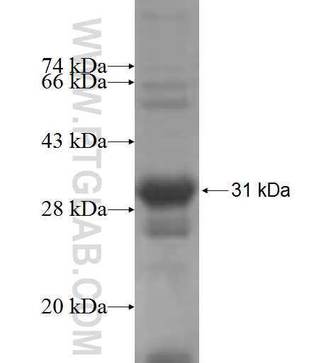 ARHGDIG fusion protein Ag6171 SDS-PAGE ARHGDIG fusion protein Ag6171 SDS-PAGE