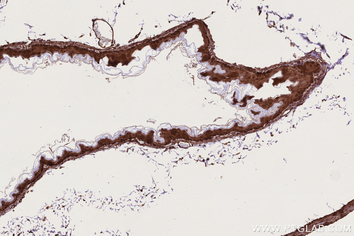 IHC staining of mouse stomach using 11363-1-AP IHC staining of mouse stomach using 11363-1-AP