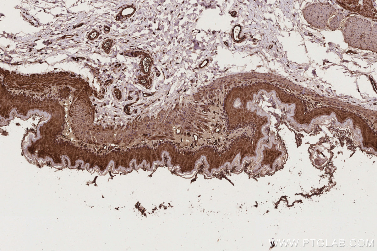 IHC staining of rat stomach using 11363-1-AP IHC staining of rat stomach using 11363-1-AP